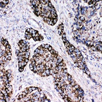 Peroxiredoxin 3/PRDX3 Antibody