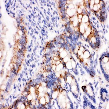 Peroxiredoxin 3/PRDX3 Antibody