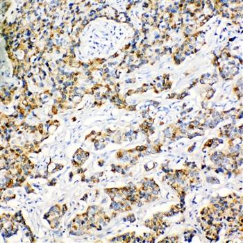 Anti-Peroxiredoxin 3/PRDX3 Antibody