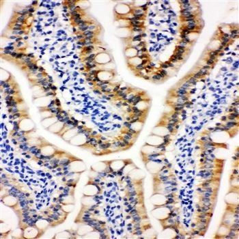 Anti-Peroxiredoxin 3/PRDX3 Antibody