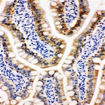 Peroxiredoxin 3/PRDX3 Antibody