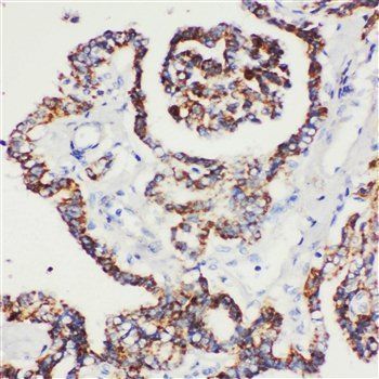 Peroxiredoxin 5/PRDX5 Antibody