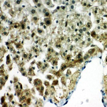 Anti-Peroxiredoxin 5/PRDX5 Antibody