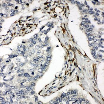 Anti-DR5/TNFRSF10B Antibody