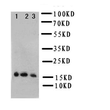 Interleukin-7 IL7 Rabbit Polyclonal Antibody