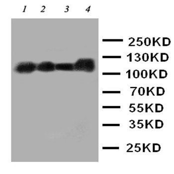 CEACAM5 Rabbit Polyclonal Antibody