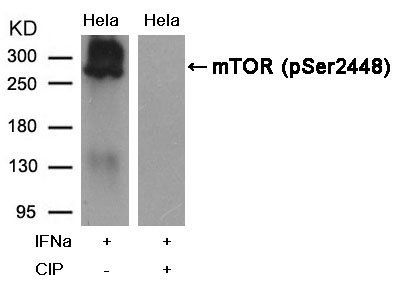 mTOR (Phospho-Ser2448) Antibody