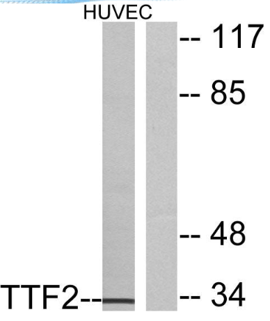 FoxE1 antibody