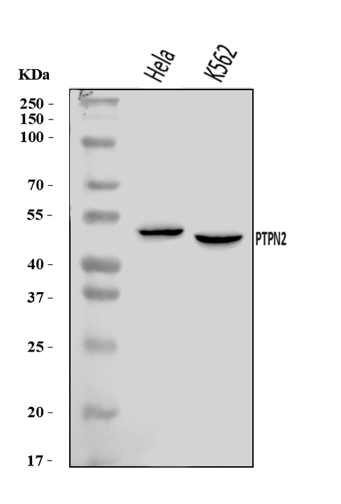 TCPTP/PTPN2 Antibody
