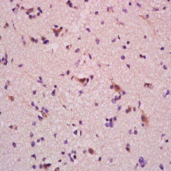 Ganglioside GM1 Rabbit Polyclonal Antibody (FITC)