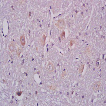 Ganglioside GM1 Rabbit Polyclonal Antibody (FITC)