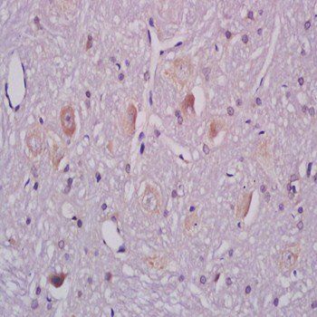 GM1(GS) antibody (FITC)