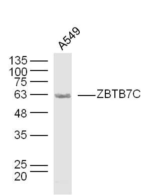 ZBTB7C Rabbit Polyclonal Antibody (AP)