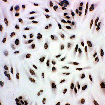 Histone deacetylase 3 HDAC3 Antibody