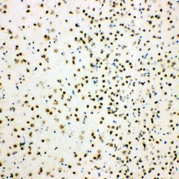 Histone deacetylase 3 HDAC3 Antibody