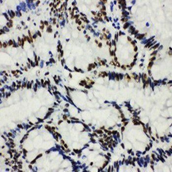 Anti-Histone deacetylase 3 HDAC3 Antibody