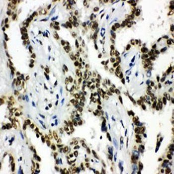 Histone deacetylase 3 HDAC3 Antibody