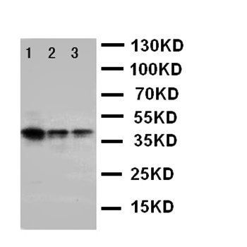 Anti-ErbB 4/ERBB4 Antibody