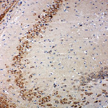 Anti-Glutaredoxin 2/GLRX2 Antibody