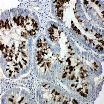 p107/RBL1 Antibody