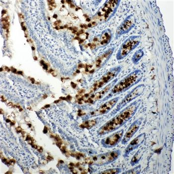 p107/RBL1 Antibody