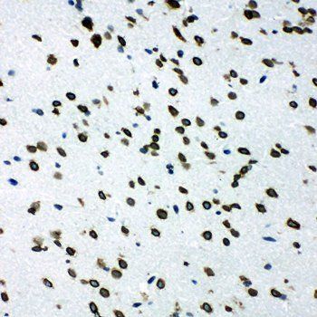 Anti-SHC/SHC1 Antibody