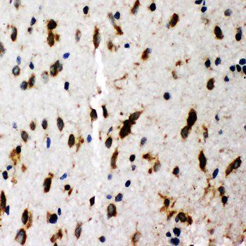Anti-SHC/SHC1 Antibody