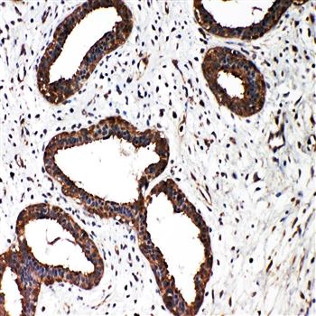 Smad2 Rabbit Polyclonal Antibody