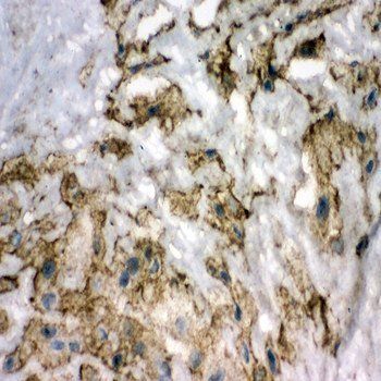 Anti-Superoxide Dismutase 3/SOD3 Antibody