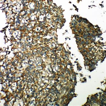 Anti-TXNRD2 Antibody