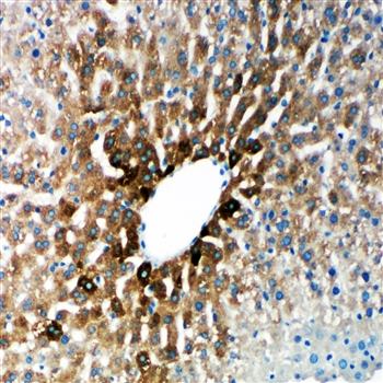 Cytochrome P450 2E1/CYP2E1 Antibody