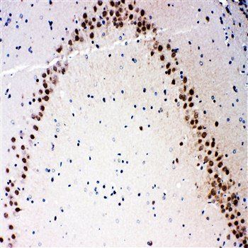 Anti-MEKK3/MAP3K3 Antibody