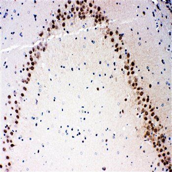 MEKK3/MAP3K3 Antibody