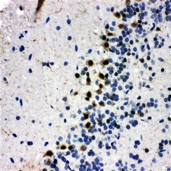 Anti-B MyB/MYBL2 Antibody