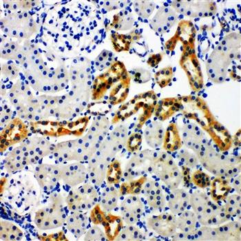 NADPH oxidase 4/NOX4 Antibody