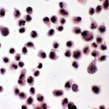 Nucleophosmin/NPM1 Antibody