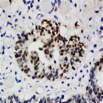 Anti-Nucleophosmin/NPM1 Antibody