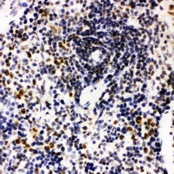 Anti-Nucleophosmin/NPM1 Antibody