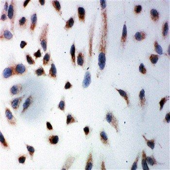 Anti-Prohibitin/PHB Antibody