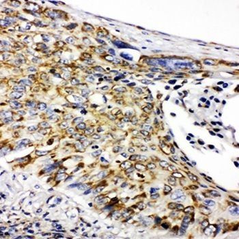 Anti-Prohibitin/PHB Antibody