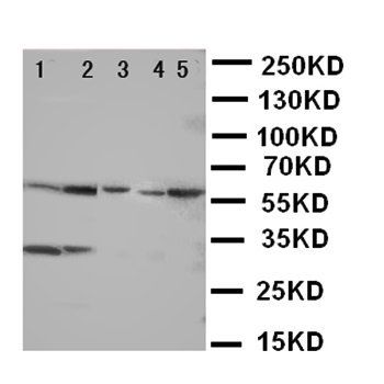 Aquaporin 4/AQP4 Antibody