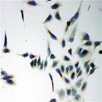 Anti-NADPH oxidase 5 NOX5 Antibody