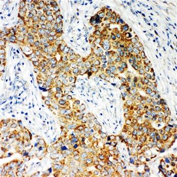 NADPH oxidase 5 NOX5 Antibody