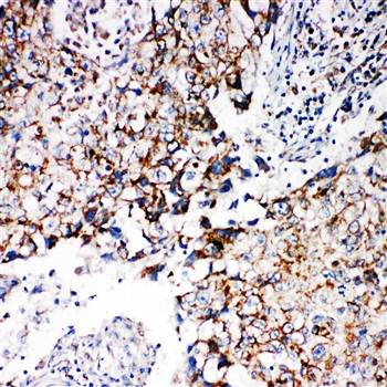 Anti-REA/PHB2 Antibody