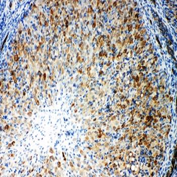 Anti-Cytochrome P450 Reductase/POR Antibody