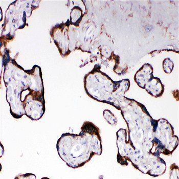 Cytochrome P450 Reductase/POR Antibody