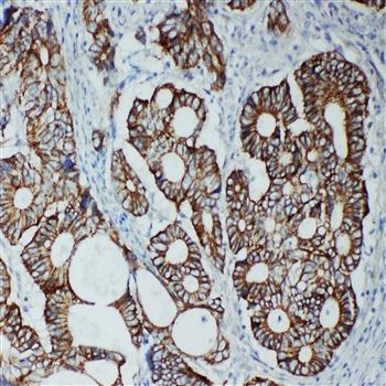 Tight junction protein ZO-2 TJP2 Antibody