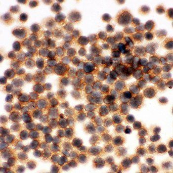 Anti-RIAM/APBB1IP Antibody
