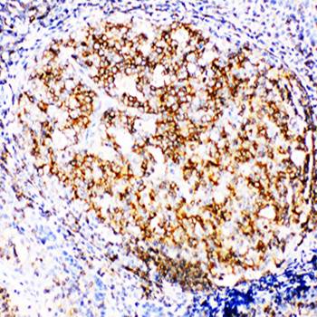 Anti-RIAM/APBB1IP Antibody