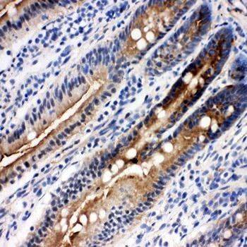 Anti-DDX4/MVH Antibody